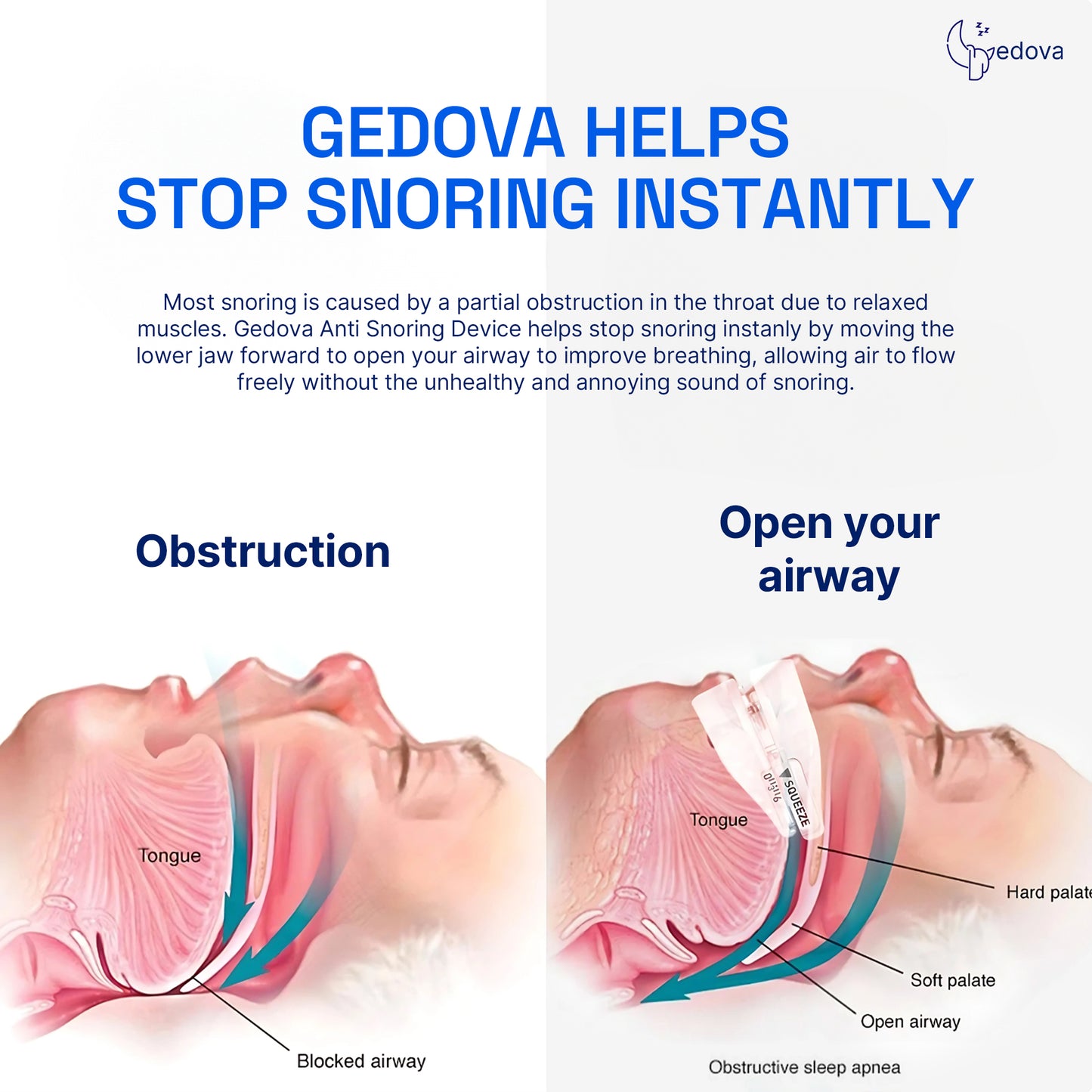 Gedova Plus